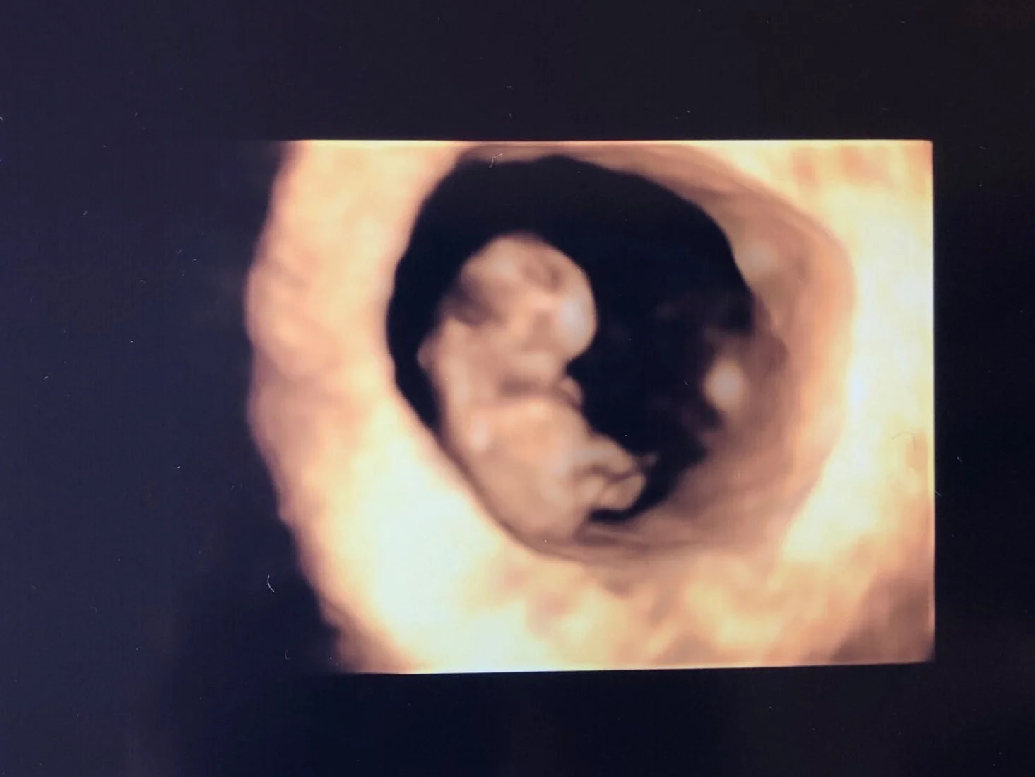 Pregnancy: 9 week ultrasound and update