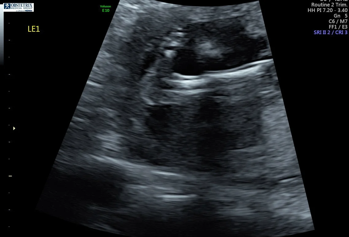 Side view of foot
