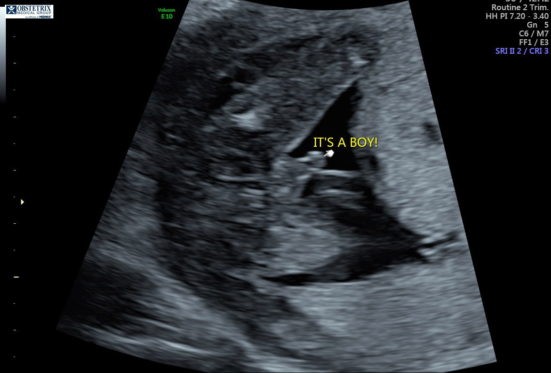 It's a boy!