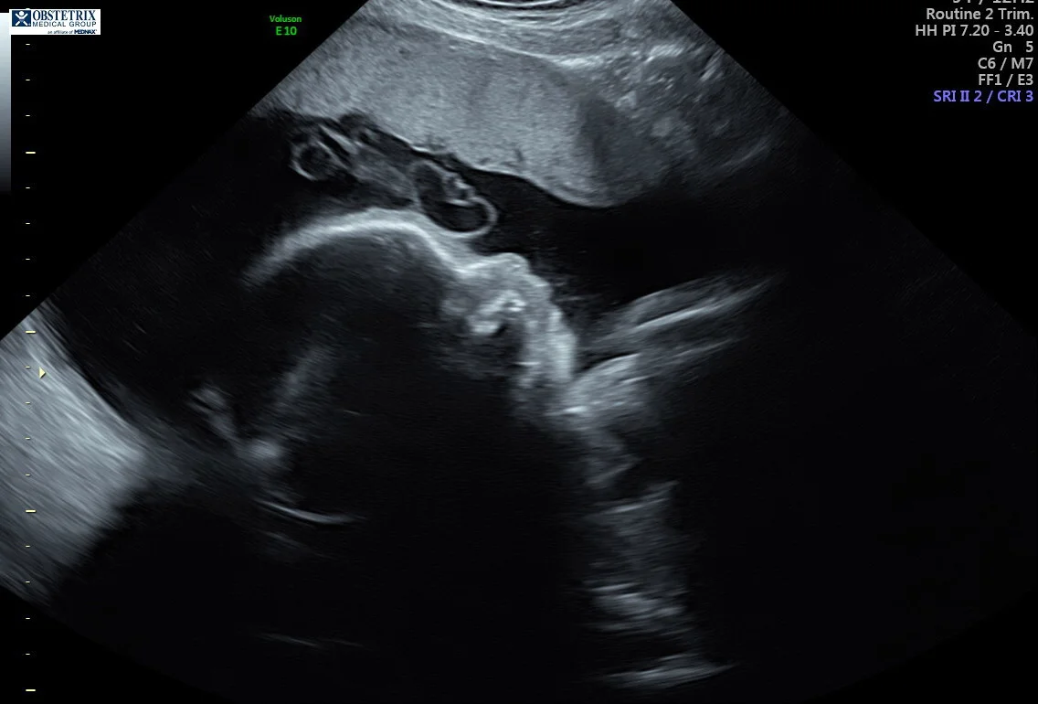 Sweet little baby boy last week. This is the fat baby head that pokes into my ribs. (I wouldn't want it any other way!)