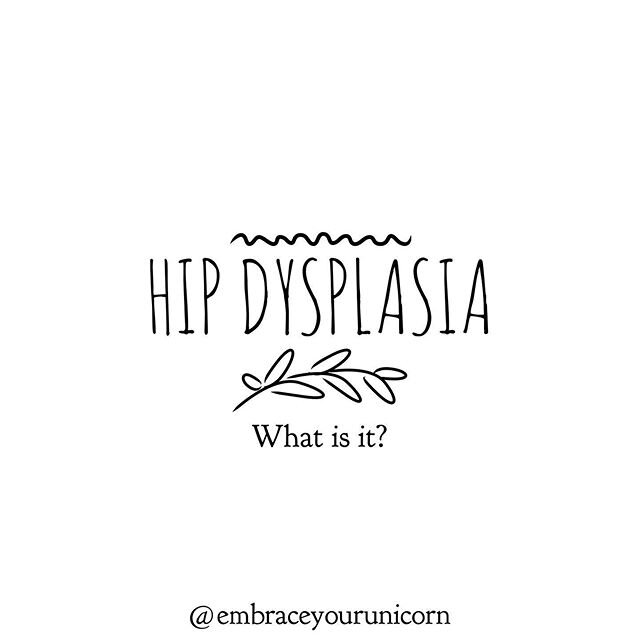My son has bilateral hip dysplasia, or developmental dysplasia of the hips (DDH). Both of his hips are dislocated and required surgery (last week) to pop back in socket. He&rsquo;ll be in a Spica body cast for the next 3 months. ⁣
⁣
I had hip dysplas