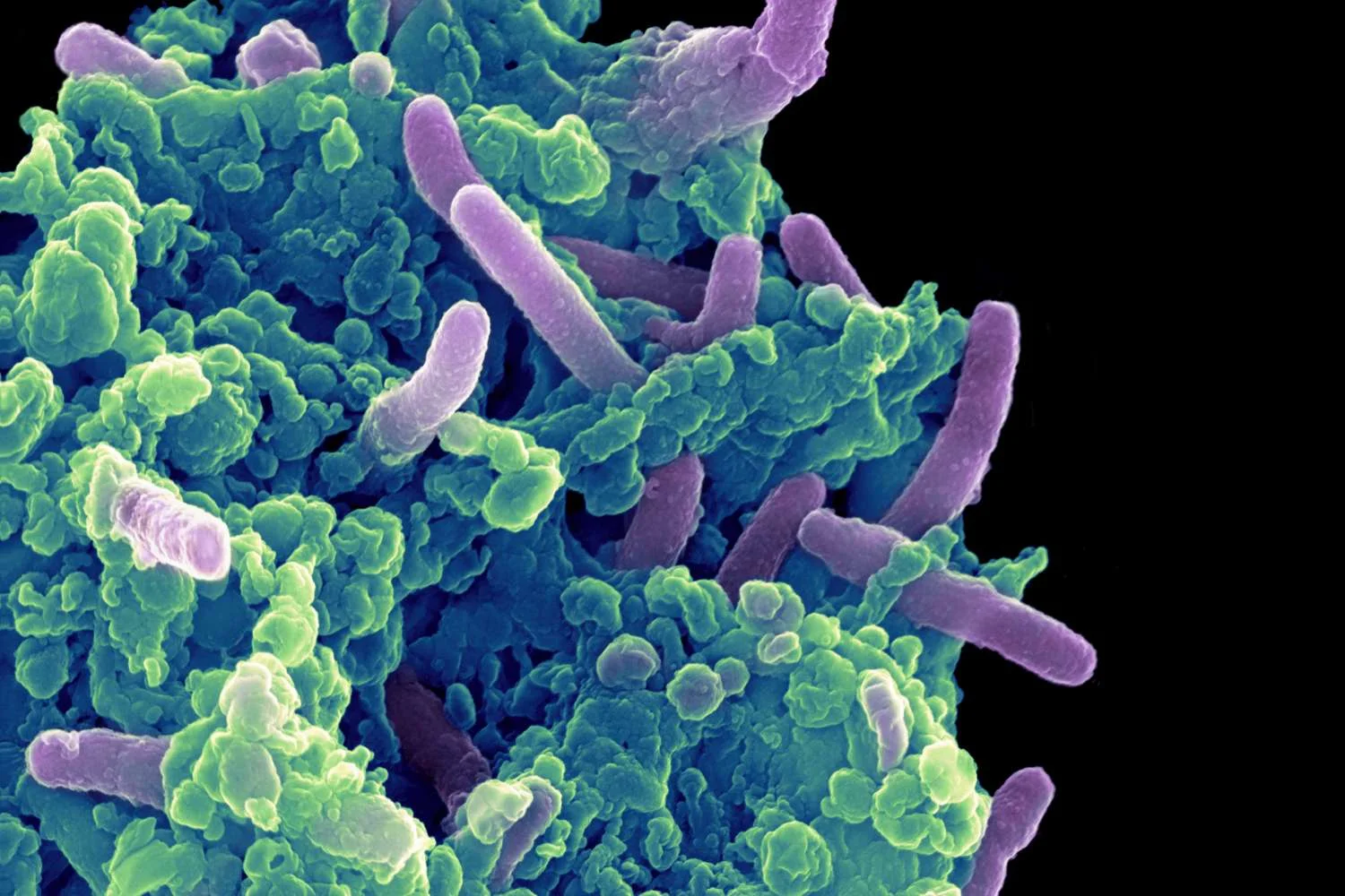 mrsa 2.jpg