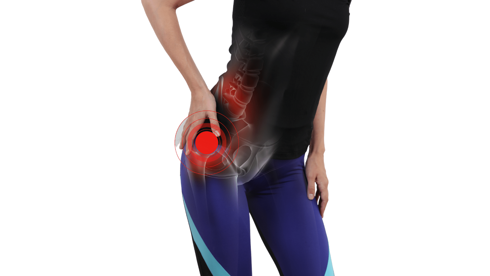 Bargain Mast hip pain