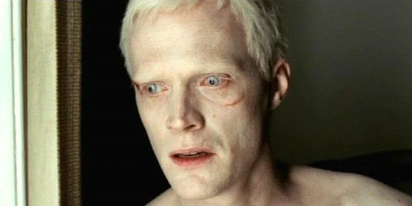 albino.jpg