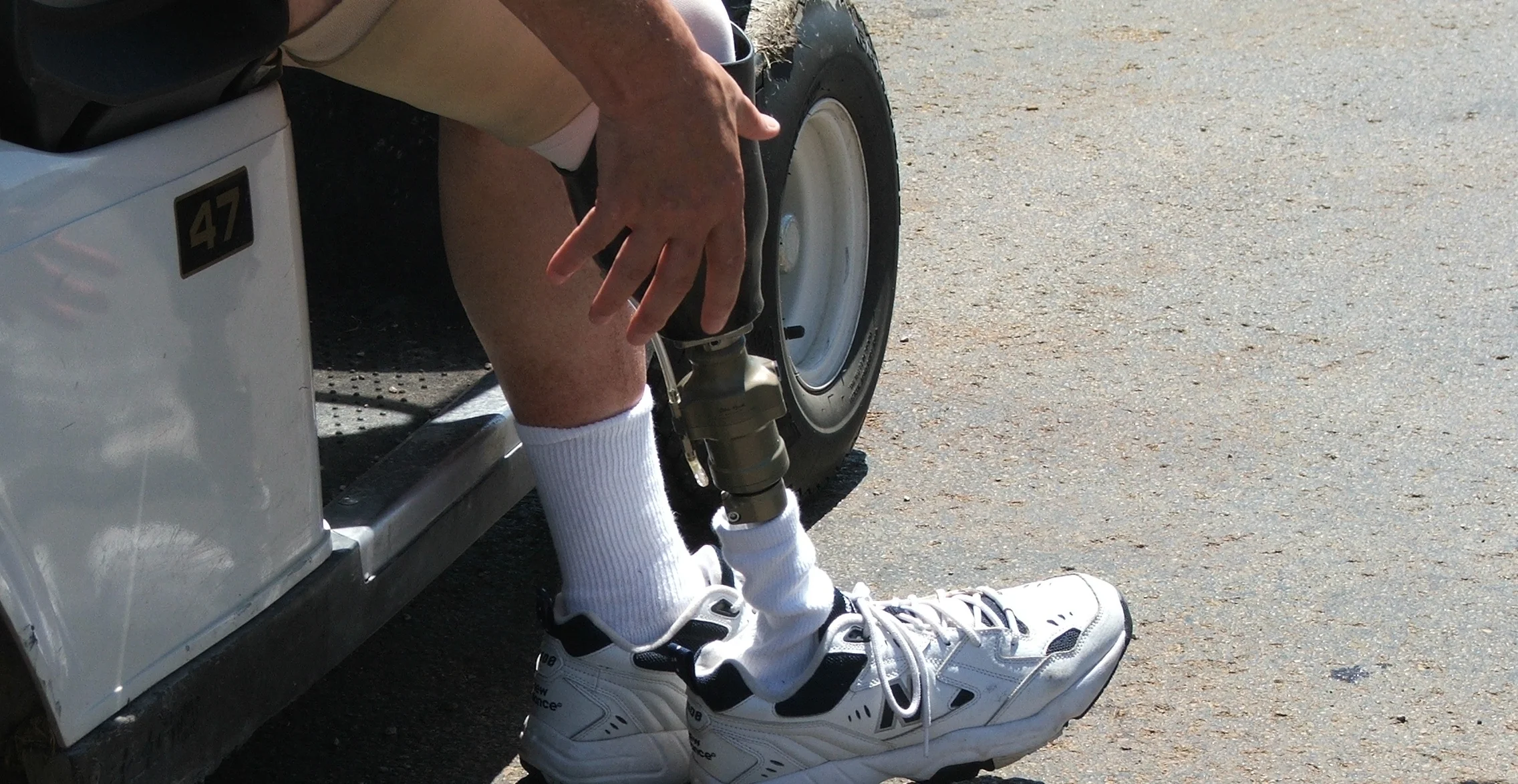 RESTOREPROSTHETICS1.jpg