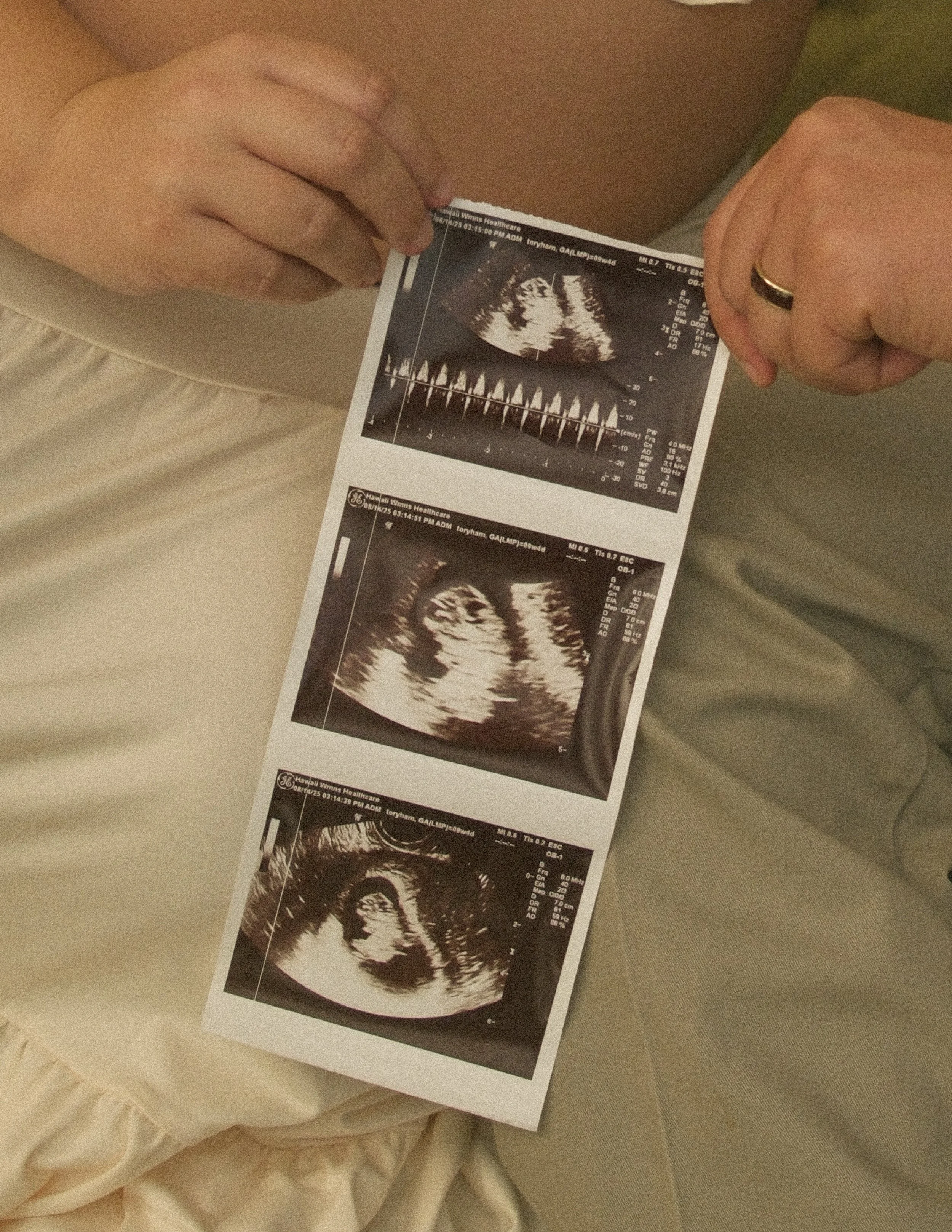 Tory and Kawai Maternity 6.jpg