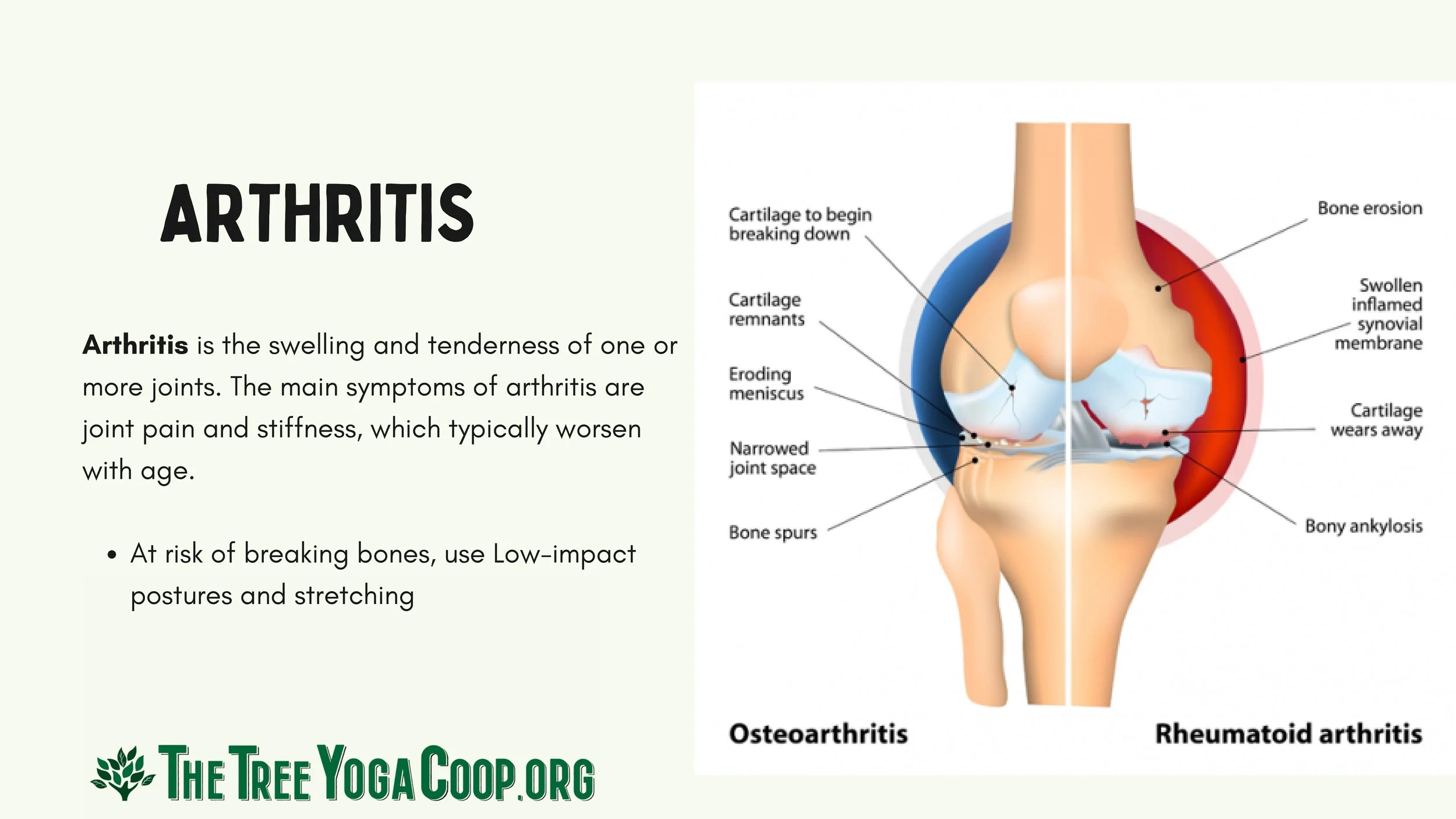 Yoga for Aging Population Training (1)-images-4.jpg
