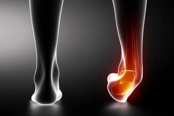 Ankle-Sprain-600x400.jpg