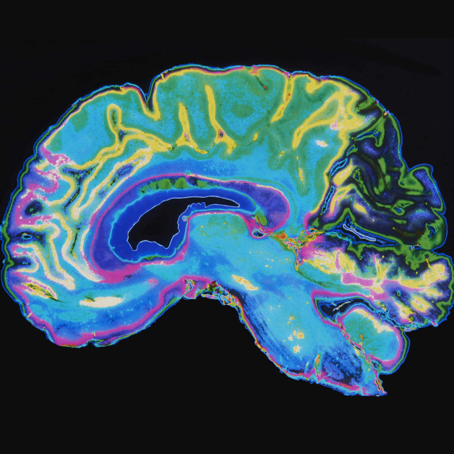 brain.jpg