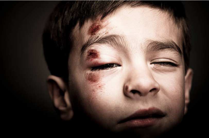 An open letter about creating more education around childhood trauma