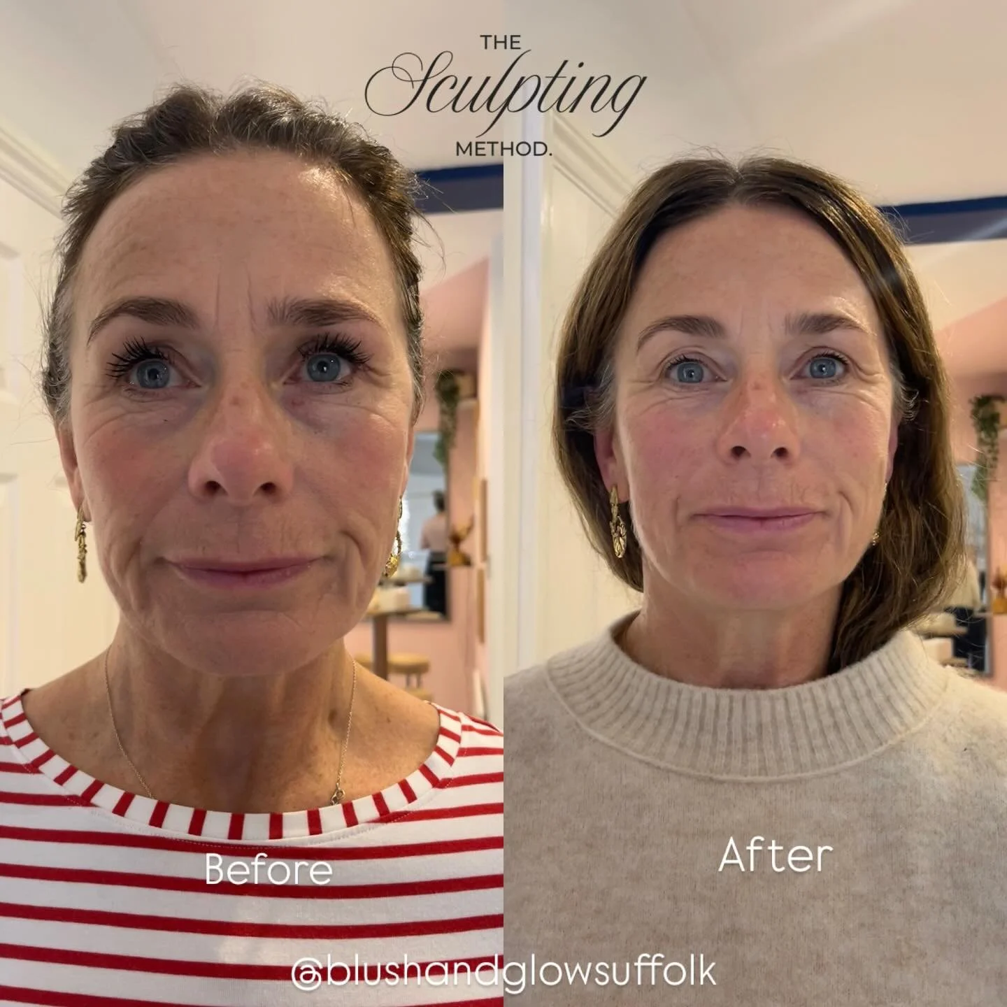 These results speak for themselves. The Sculpting Method works! 
Lifted and plumped skin from the most deeply relaxing experience. Try our 50 minute or 65 minute sculpt with 20% off until 11/12 ☁️
#facial #massage #facemassage #southwold #selfcare