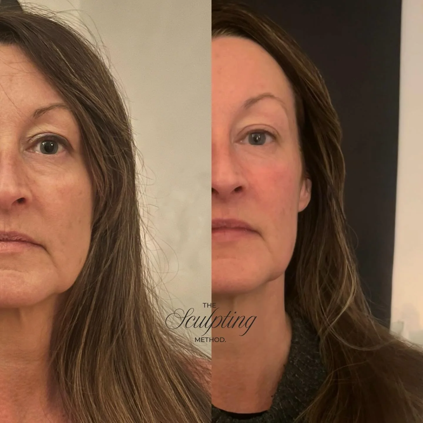 &lsquo;It&rsquo;s just massage&rsquo; &hellip; but look at the results. 
The most relaxing facial comes with the most amazing result. But it&rsquo;s more than that. It&rsquo;s also about releasing years of built up tension and stored emotion. Our fac