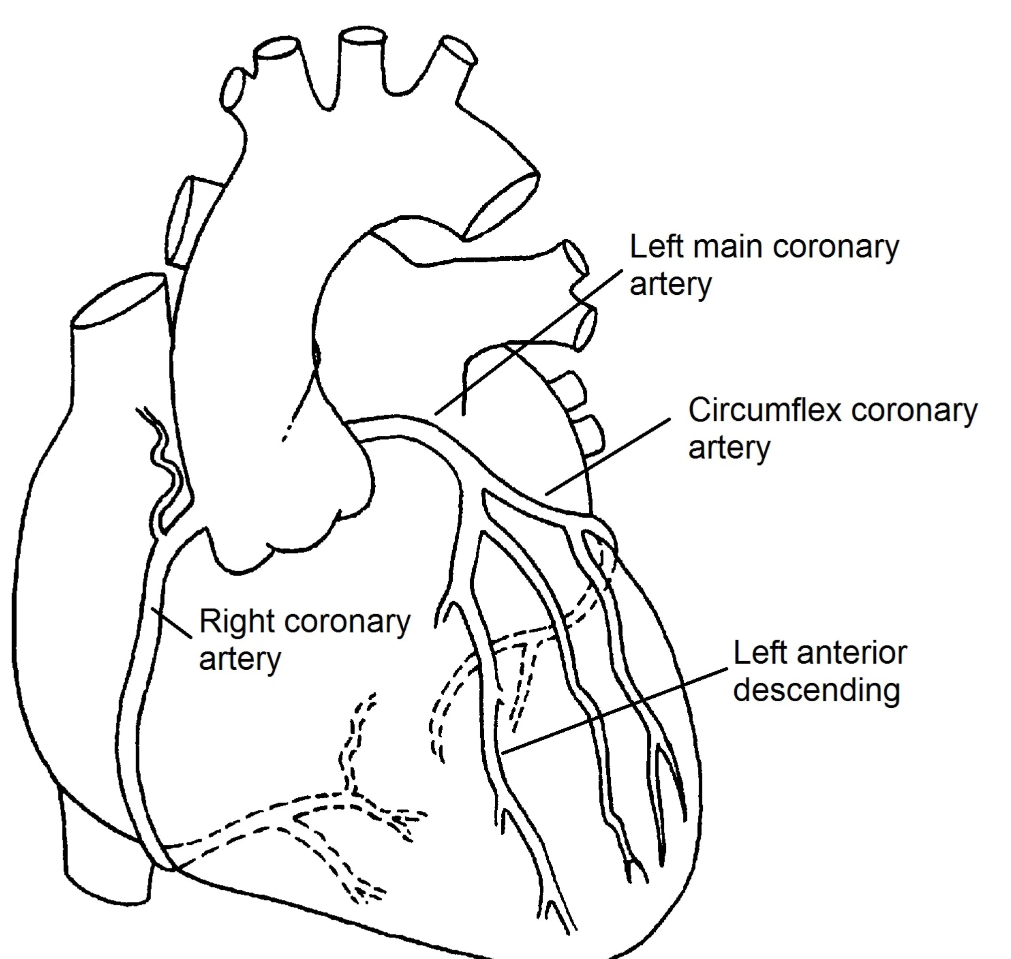 Артерии сердца схема. Coronary Anatomy. RCA lad коронарные артерии.