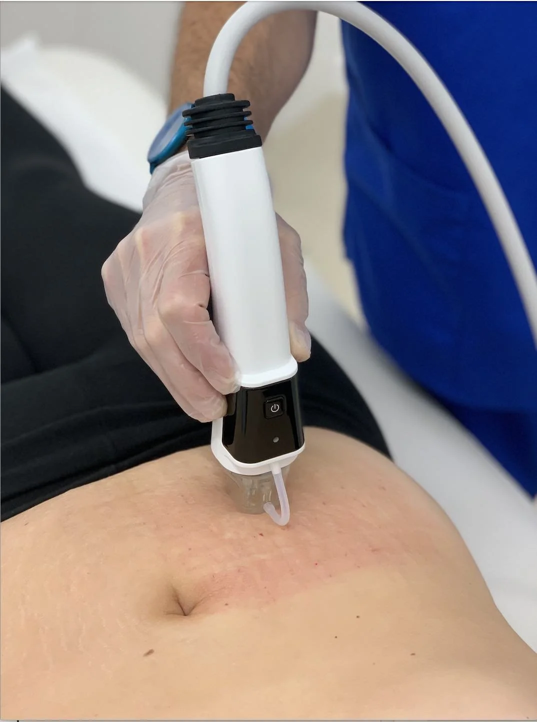 3D dermaforce 2 small.jpg