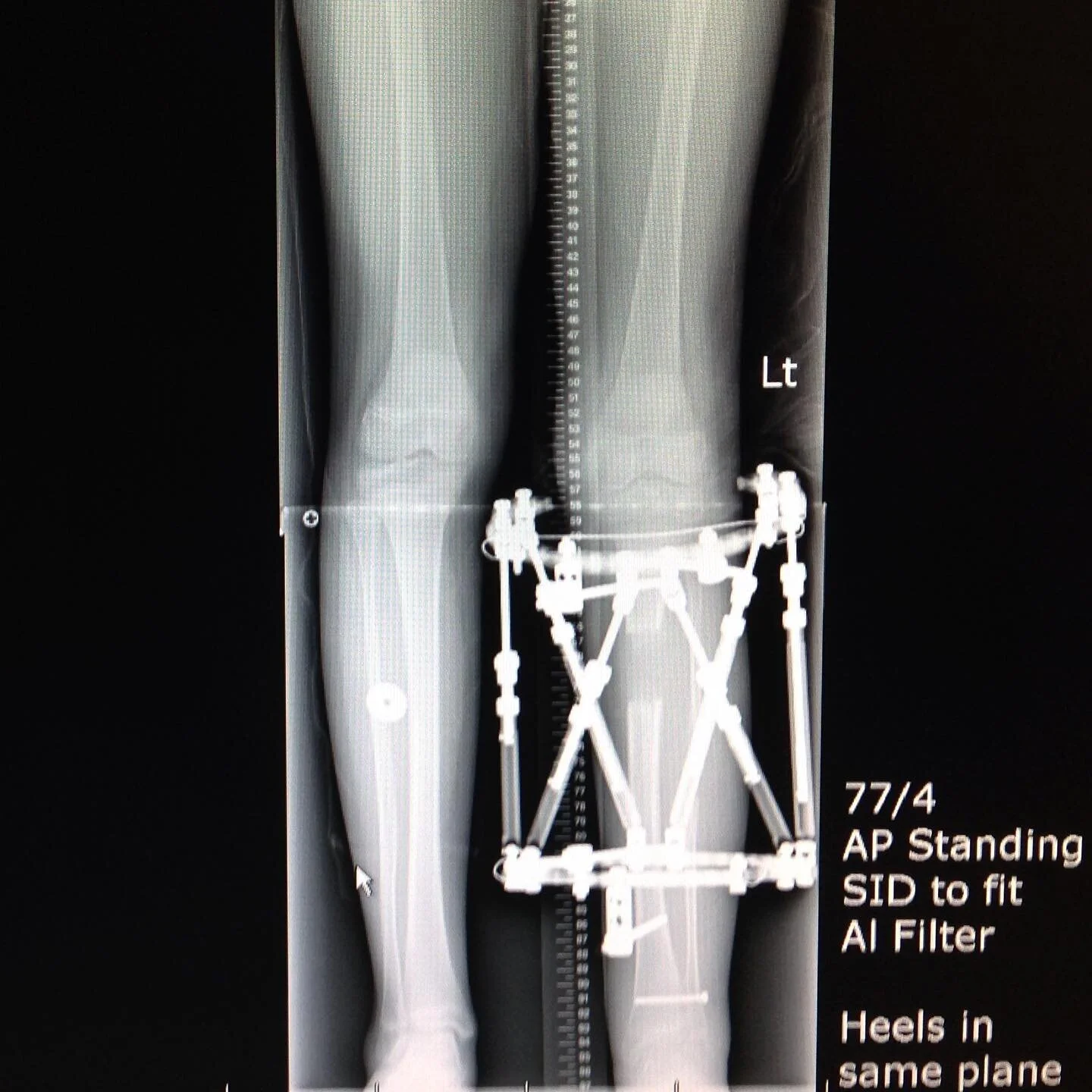 Wishing everyone a very merry Christmas!🎅🏼🍪🎄
We hope your day is full of time spent with loved ones, Christmas traditions, and of course lots of christmas cookies!

#walktallgala #bcch #bcchildrenshospital