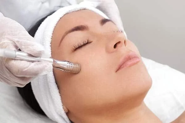 What are the benefits of microneedling?