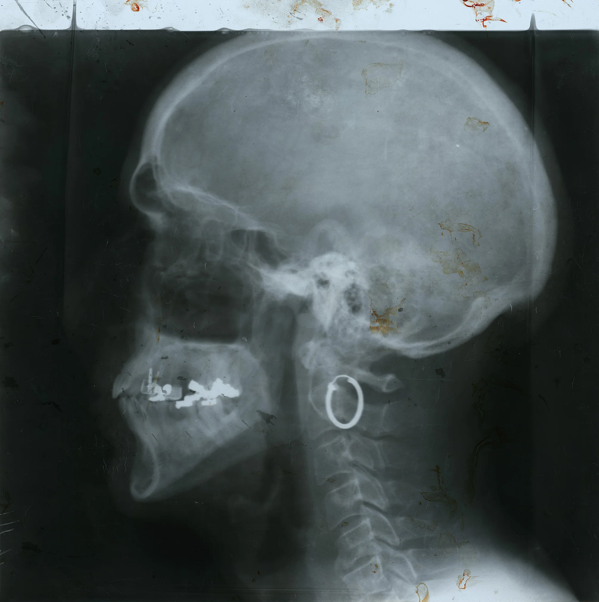 placa-small.jpg