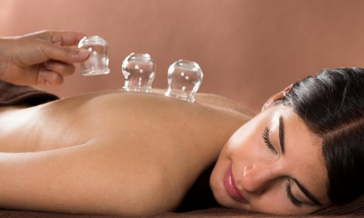 Cupping-Spa.jpg