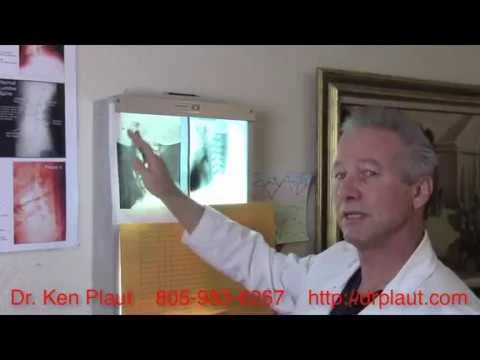 How to interpret X Rays for headaches and neck pain (Copy)