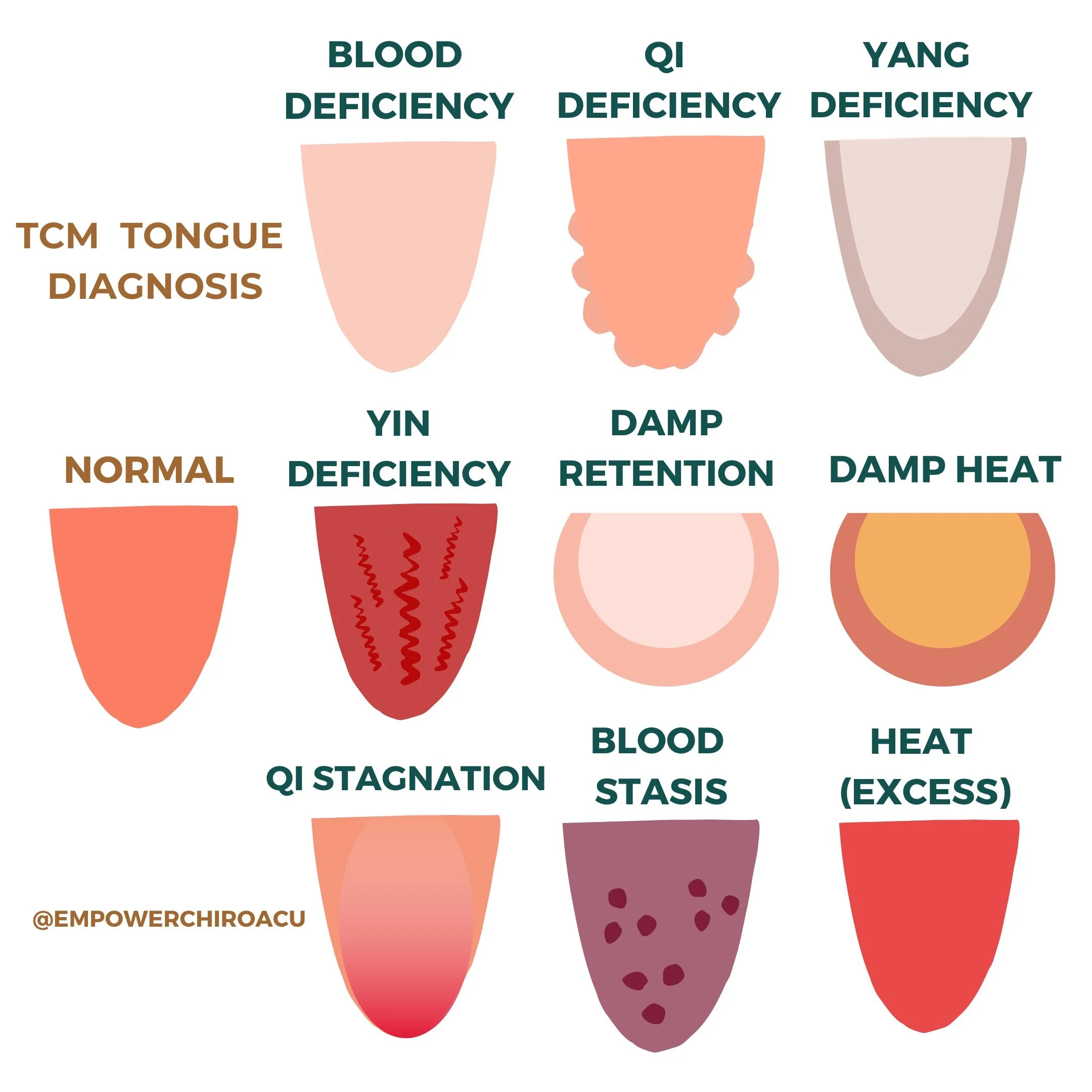 What Does Your Tongue Say About Your Health Empower Chiropractic Acupuncture