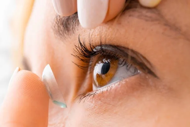 What Are Contact Lenses? 