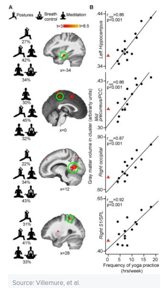 BrainYoga.png