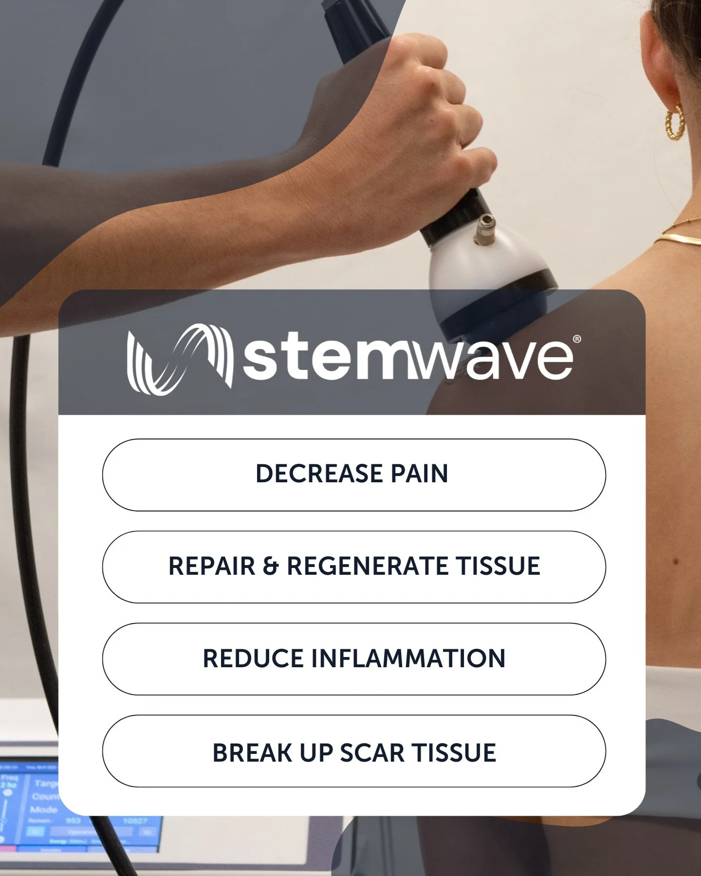 Stemwave StemWave — Malchar Chiropractic & Wellness Center