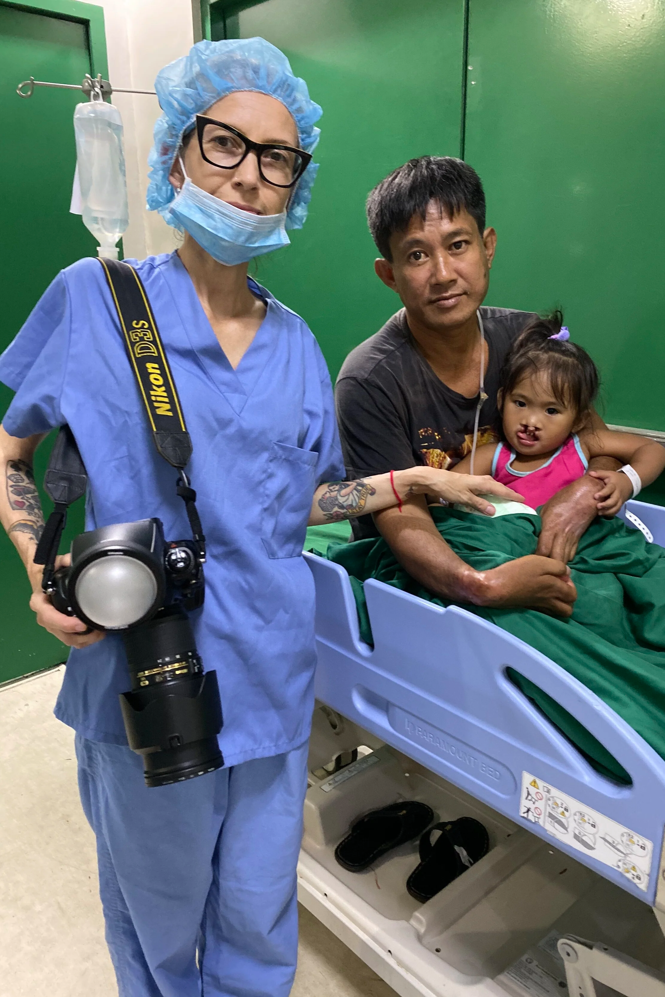 Before the surgery. Alliance for Smiles 