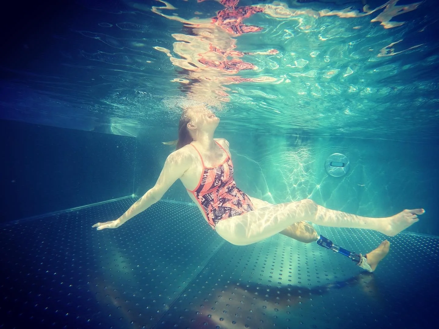 BLOG – In search of a prosthetic revolution:  from charity to investment