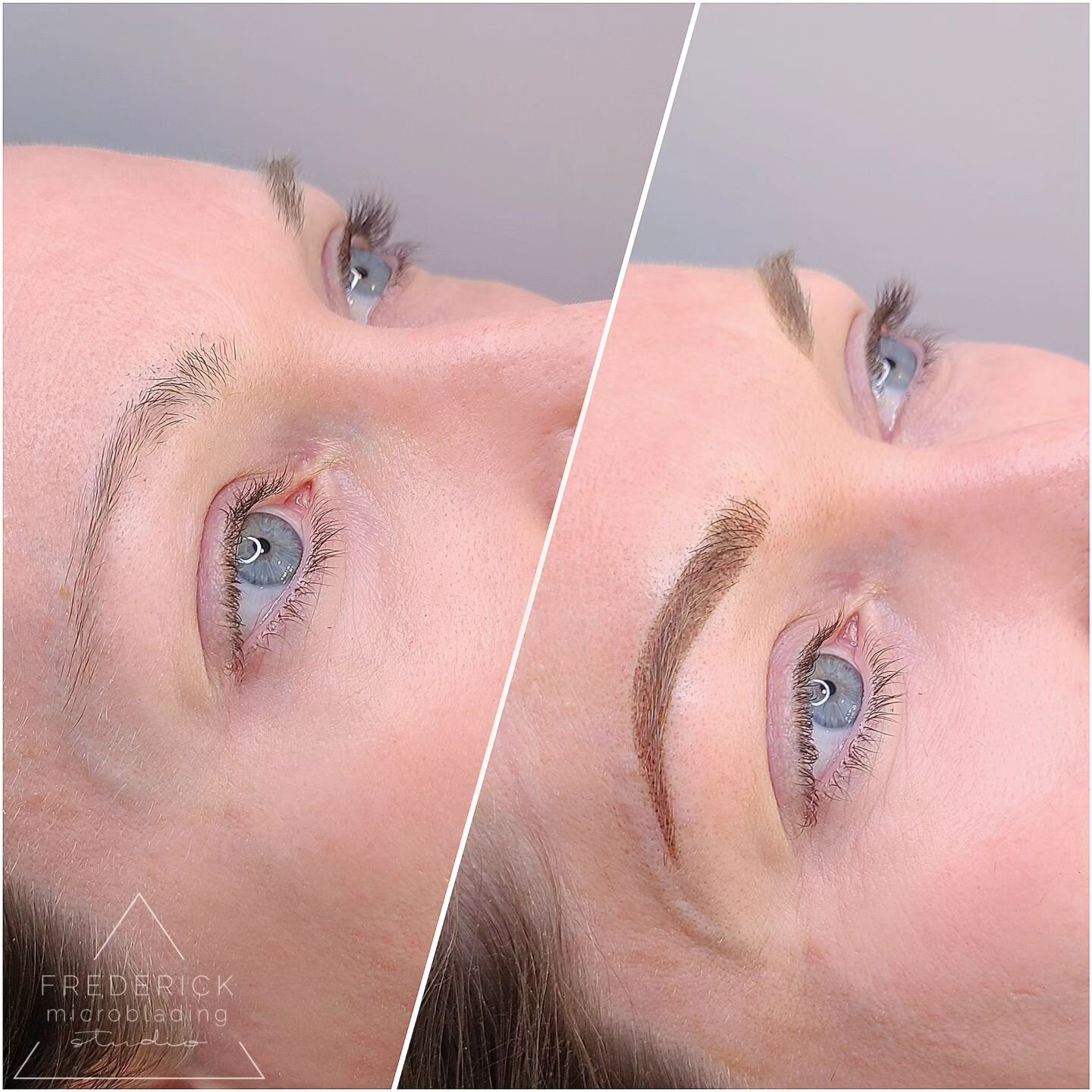 🌿 Embrace your natural beauty with a new brow shape that stays within your natural hairline! ✨ Say goodbye to harsh lines and hello to a more soft brow shape that enhances your features 🌿
#NaturalBrowBeauty  #BrowTransformation #BrowGoals #BeautyTi