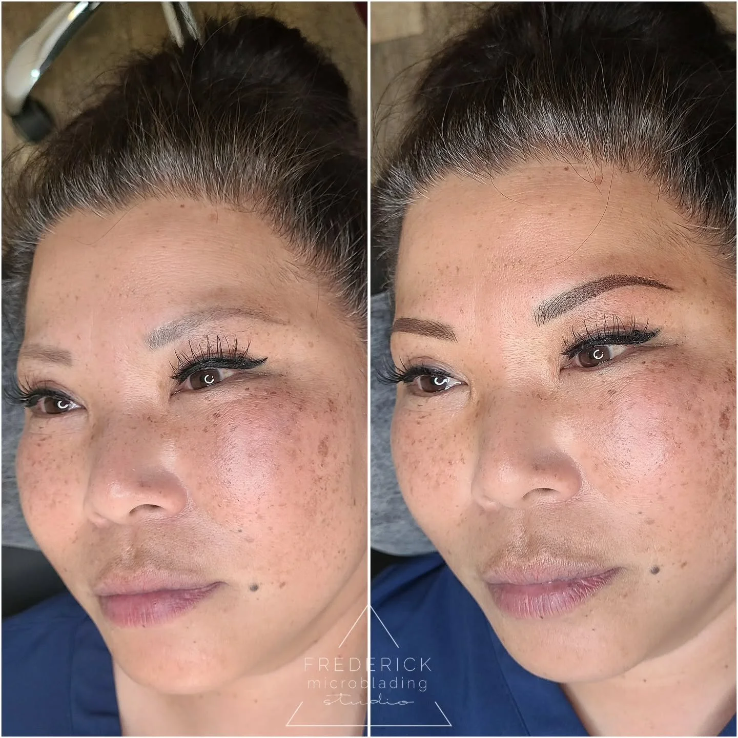 After several laser removal sessions with @cosmetic_skin_surgery_center to fade her old tattooed brows, this client was finally ready for a fresh start! We went over the lightened base and gave her brows a soft, new look she can feel confident about.