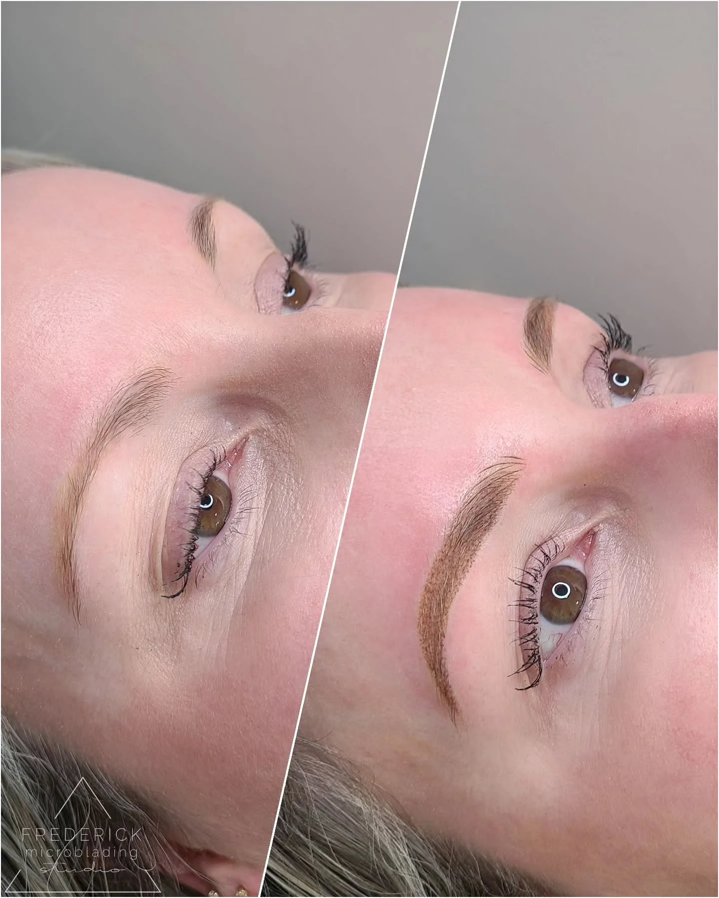 Fresh start, fresh brows ✨
After going through laser removal, we were able to create a brand new shape that&rsquo;s bold, balanced, and made just for her.
Trusting the process always pays off and these results say it all 🤎
#frederickmicrobladingstud