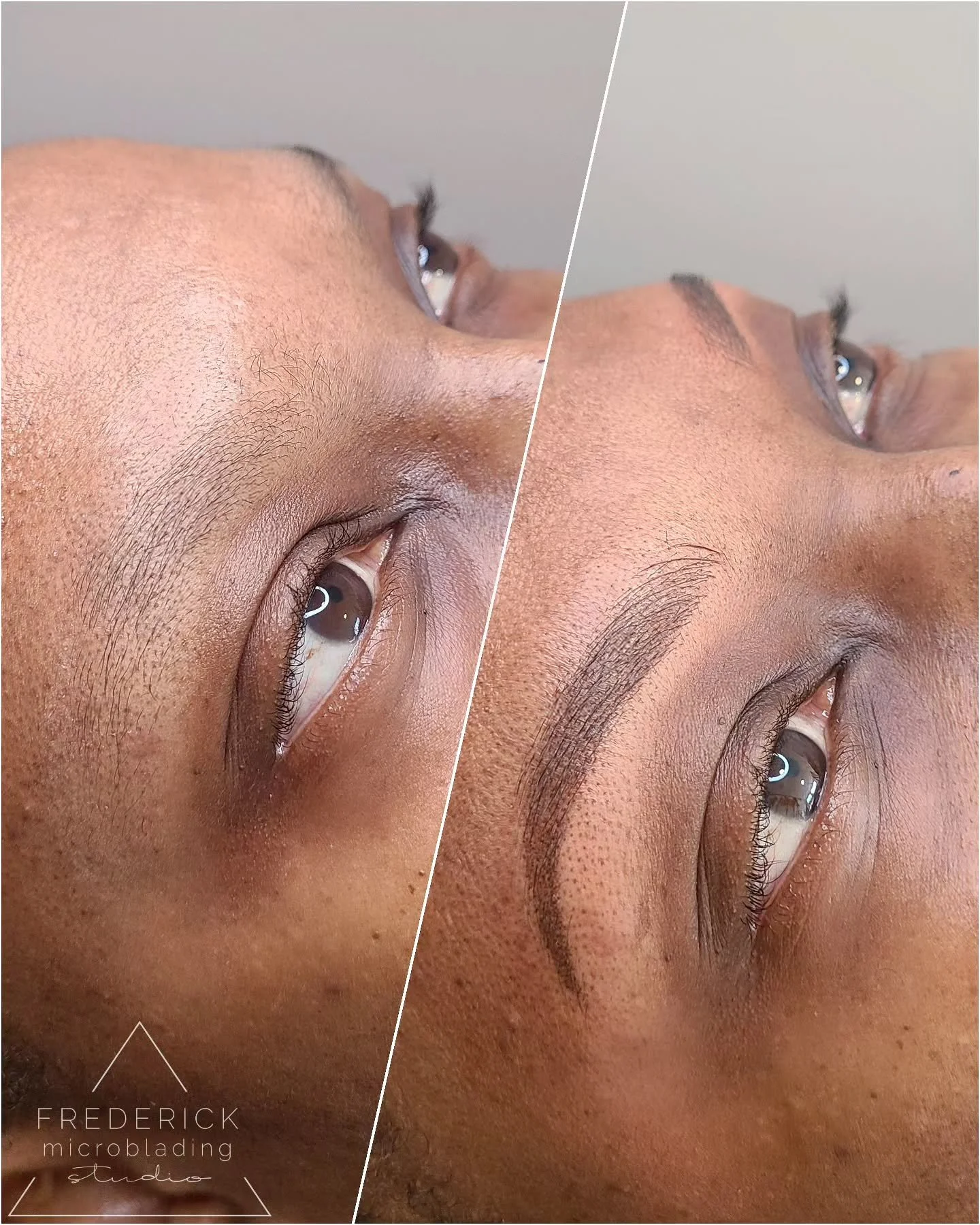 🌸Spring is a perfect time to schedule your brow appointment🌸. It gives yourself enough time to heal before all the sun, sweat, and travel. So you can enjoy effortless, low-maintenance beauty all summer long 😎
#frederickmicrobladingstudio 
#cosmeti