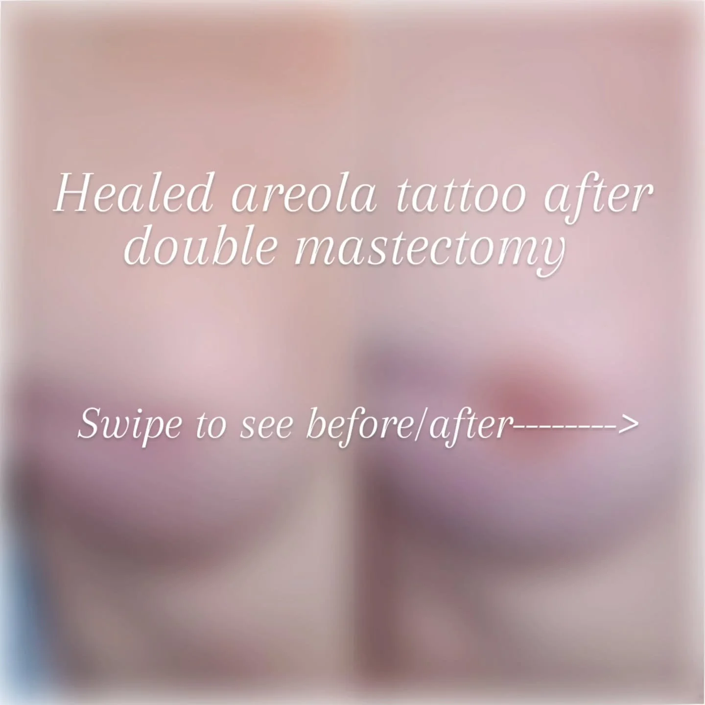 This beautiful healed areola tattoo was created for a client after a double mastectomy.

Paramedical tattooing is more than cosmetic. It&rsquo;s restorative artistry designed to help survivors feel more like themselves again. 🤍

Every journey is uni