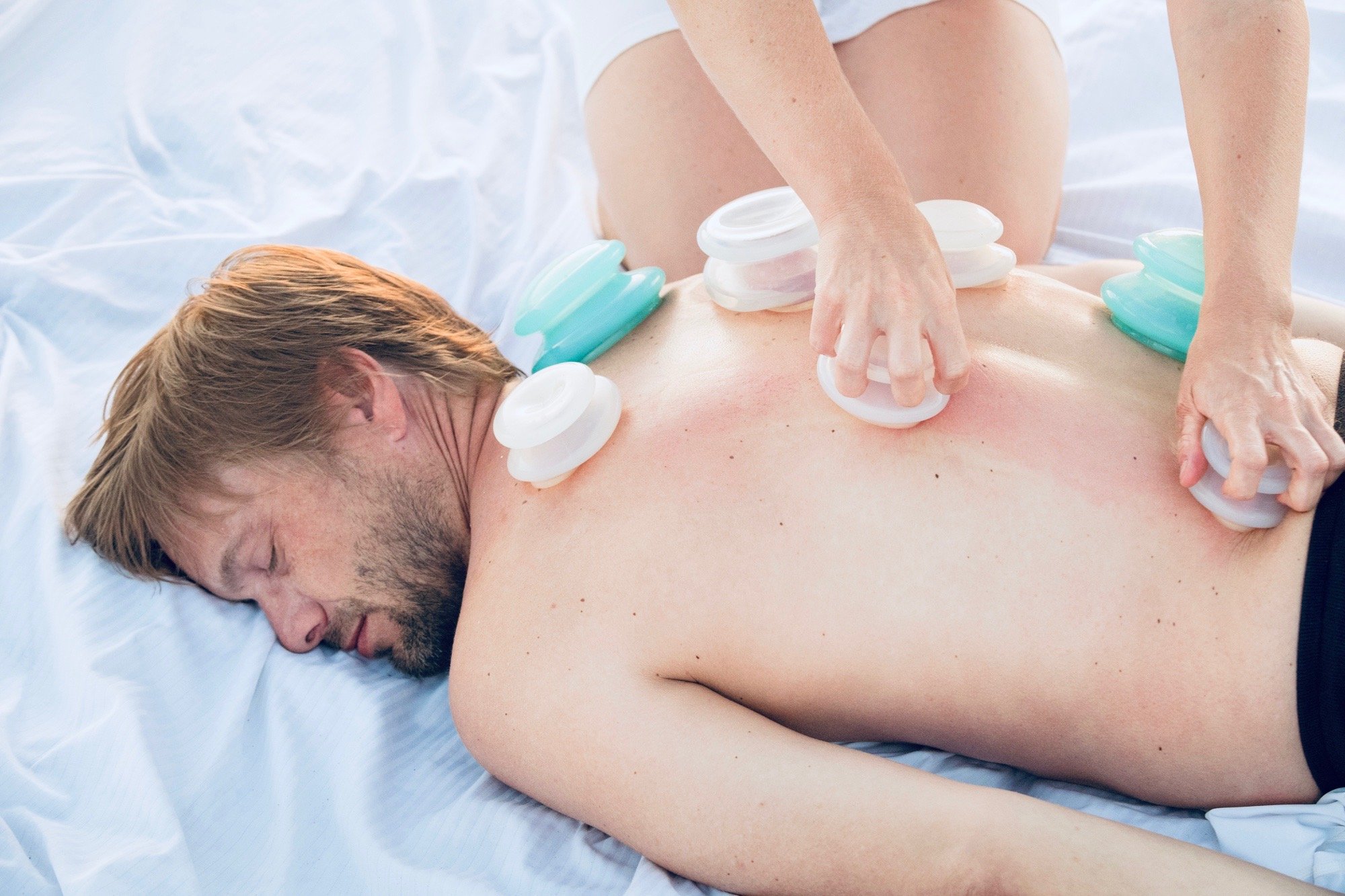 cupping_therapy_sunshine_massage_studio_vail.jpeg