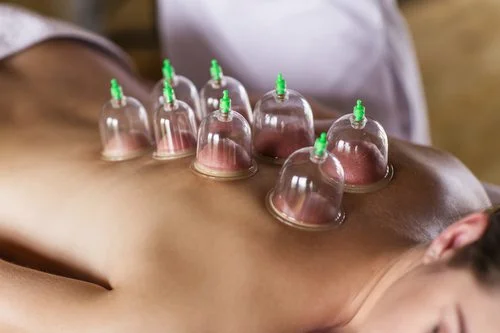 cupping.jpg