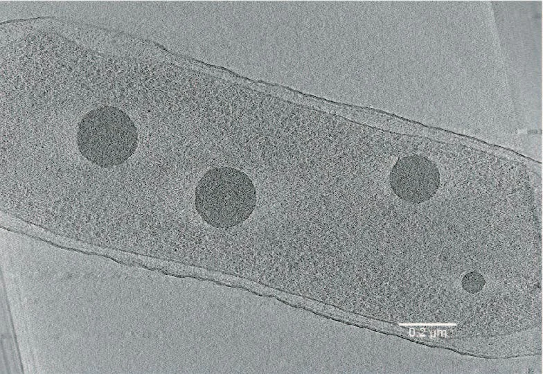 Polyphosphate granules in a Pseudomonas aeruginosa cell starved 3 hours for nitrogen