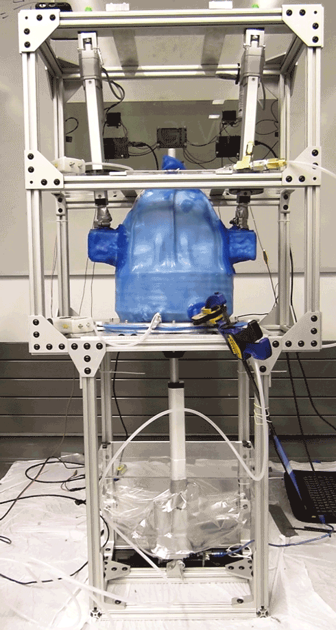 Lungevity-GIF-smaller.gif