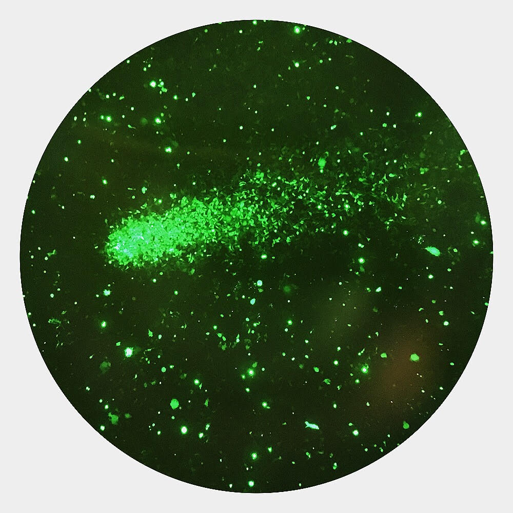 HeLa cells infected with GFP recombinant adenovirus