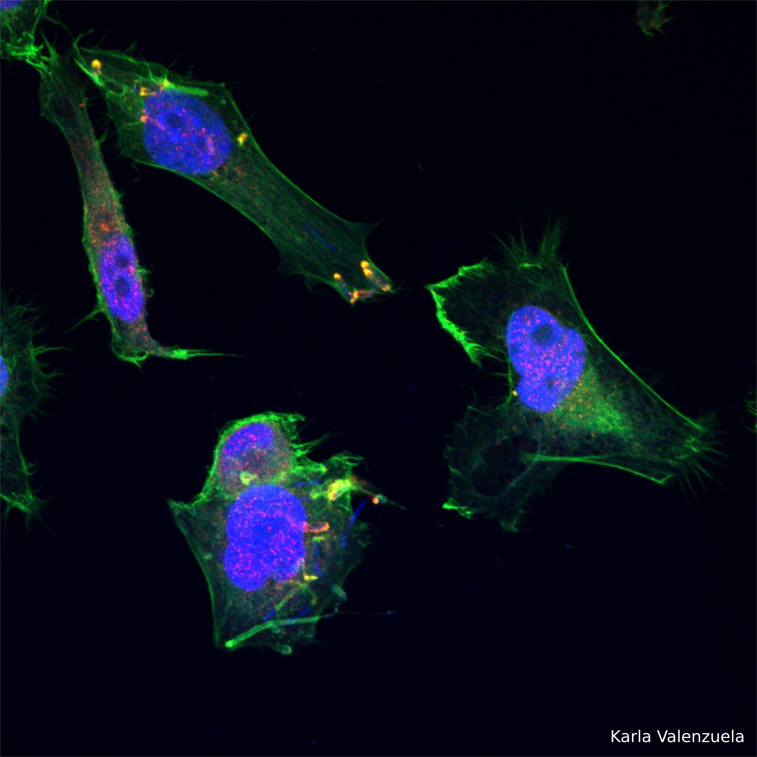 Hela cells infected with Shigella flexneri M90T