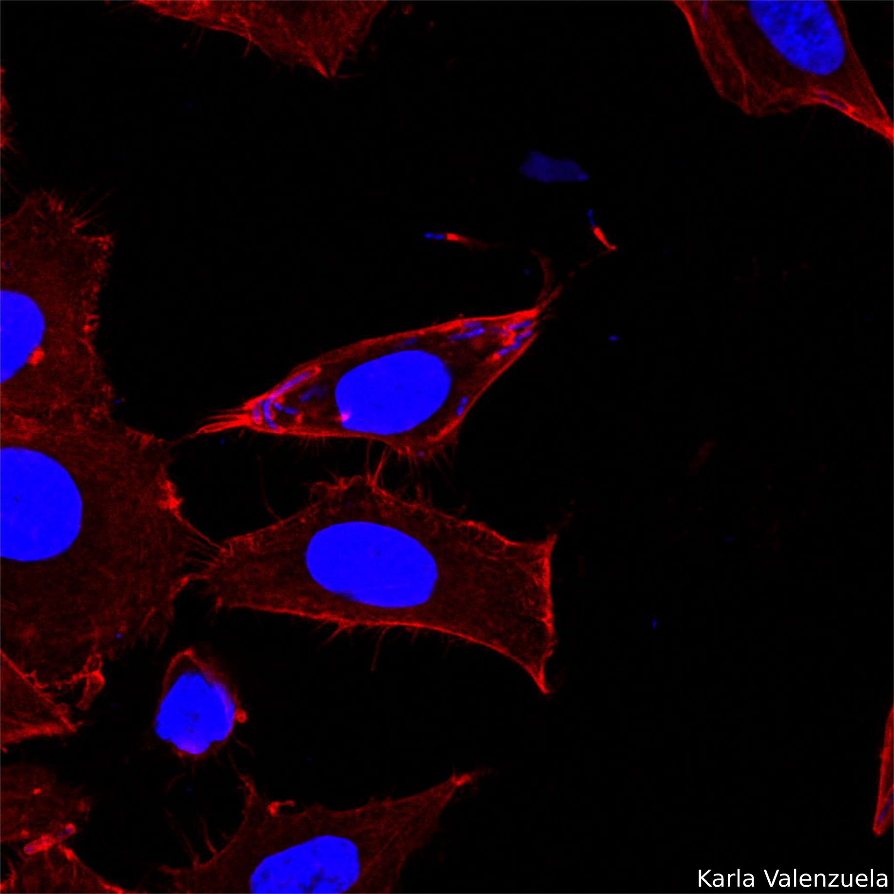 Hela cells infected with Shigella flexneri M90T