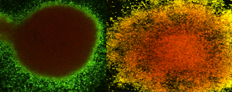  Confocal laser scanning microscopy (magnification power 63X) for biofilm&nbsp;grew under&nbsp;dynamicconditions, exposed&nbsp;to&nbsp;combination&nbsp;of alginate lyase and&nbsp;&nbsp;tobramycin. staining&nbsp;with&nbsp;Syto&nbsp;61 red, emission fl