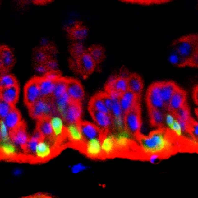 Striking image_Gut multi-layering.jpg