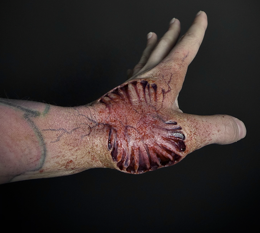 wound 9.png