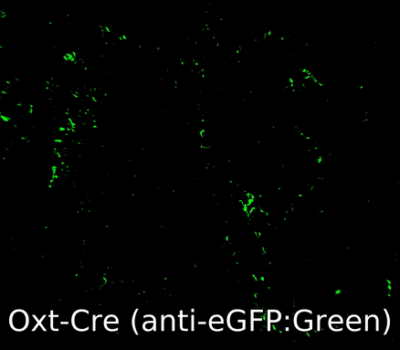 Oxt-Cre_Th_Adipose_crop.gif