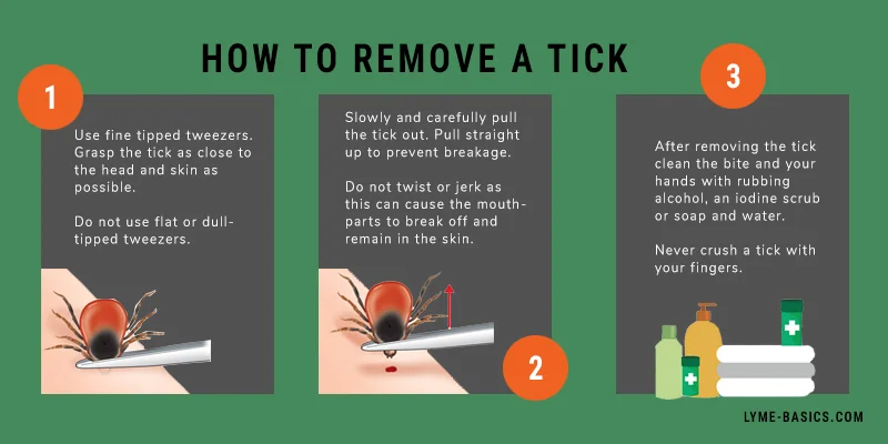 remove-a-tick.jpg