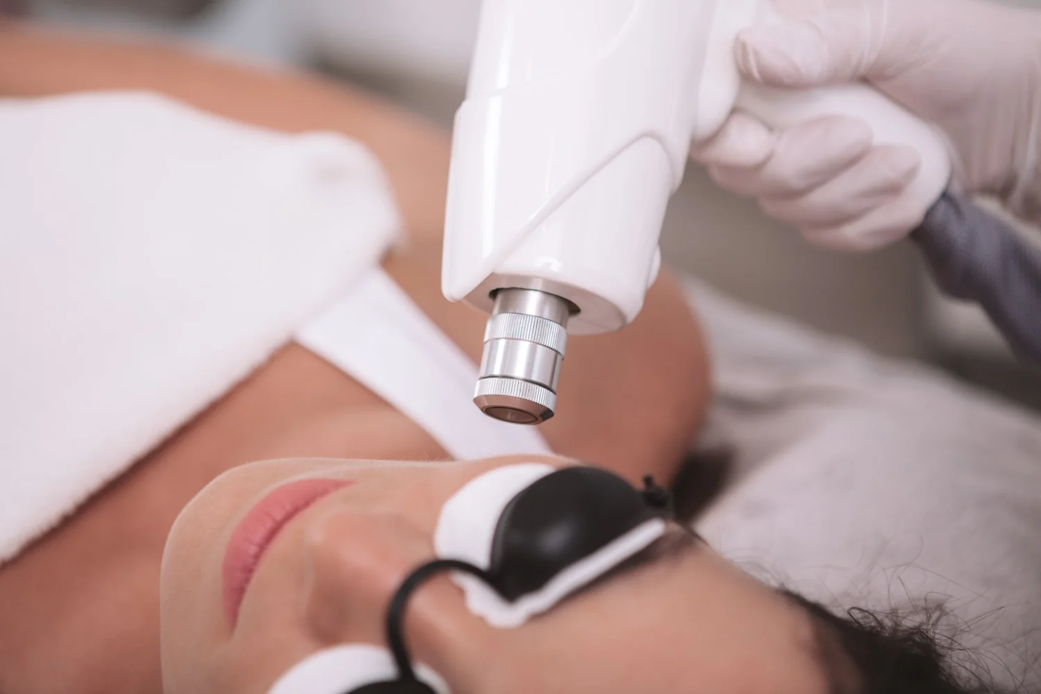 Laser Skin Treatments — Winchester | The Secret Garden Skin Clinic
