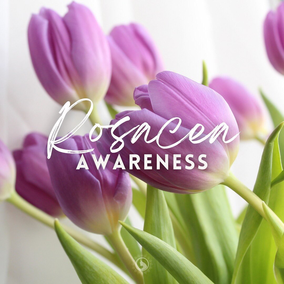 April is #rosaceaawarenessmonth and we&rsquo;re here for you if you&rsquo;re struggling. 💜

Rosacea is a very common long-term skin condition that results in central redness and visible blood vessels on the face.

We offer a number of treatments tha