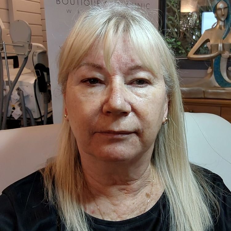 Jane Butcher Before.jpg