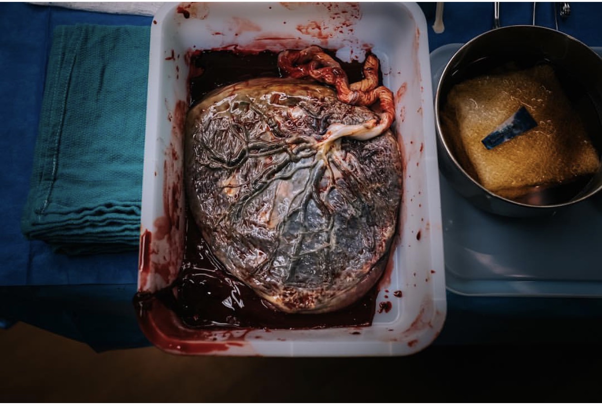 Your Placenta, Your Choice